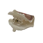 کلیپس برجسته 00202277Br